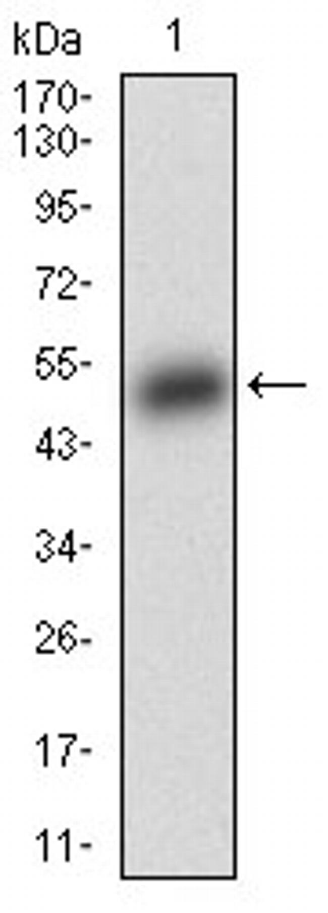 BAD Antibody in Western Blot (WB)