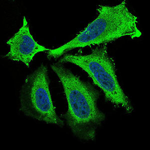 BDNF Antibody in Immunocytochemistry (ICC/IF)