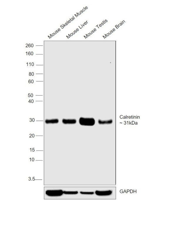 Calretinin Antibody in Western Blot (WB)