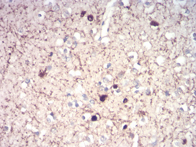 Calretinin Antibody in Immunohistochemistry (Paraffin) (IHC (P))