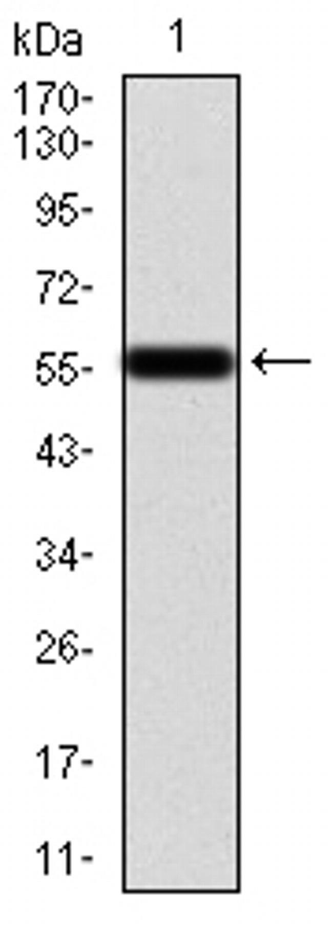 Calretinin Antibody in Western Blot (WB)