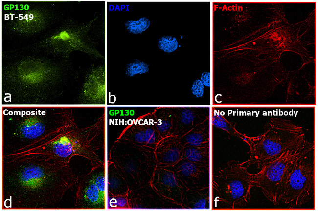 GP130 Antibody in Immunocytochemistry (ICC/IF)