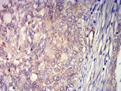 ADAM8 Antibody in Immunohistochemistry (Paraffin) (IHC (P))