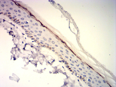 Langerin Antibody in Immunohistochemistry (Paraffin) (IHC (P))