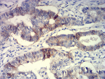 BCAM Antibody in Immunohistochemistry (Paraffin) (IHC (P))