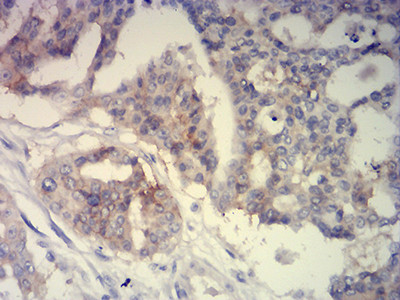 BCAM Antibody in Immunohistochemistry (Paraffin) (IHC (P))