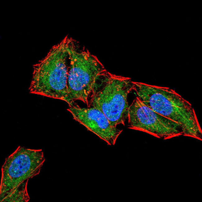 CD6 Antibody in Immunocytochemistry (ICC/IF)