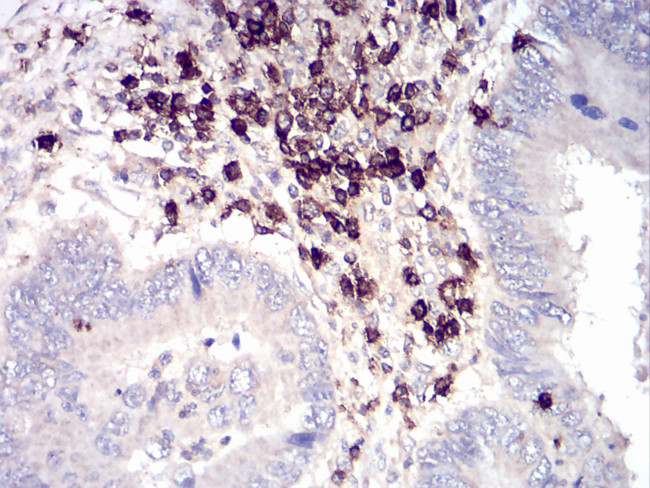 CD6 Antibody in Immunohistochemistry (Paraffin) (IHC (P))