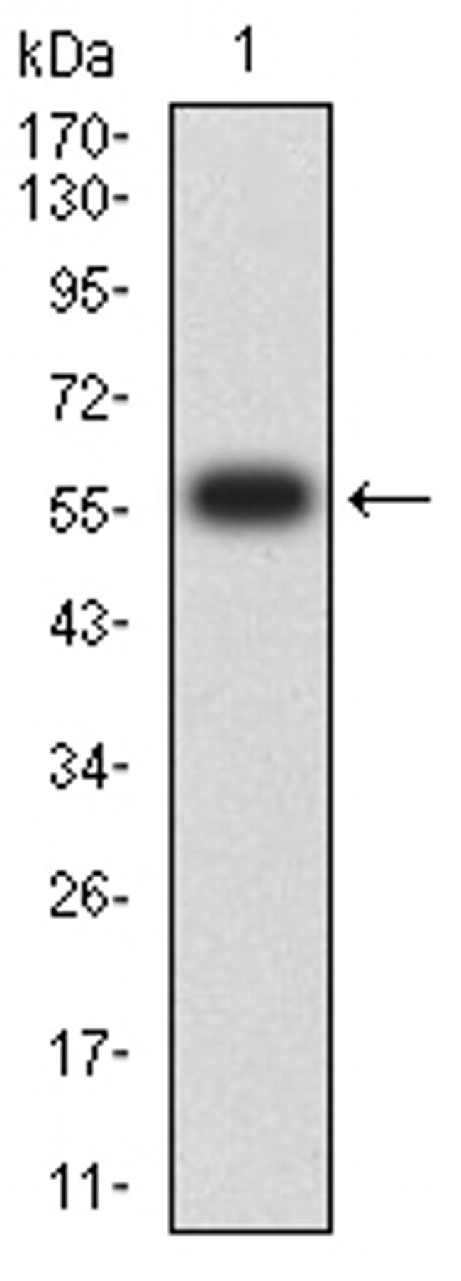 uPAR Antibody in Western Blot (WB)