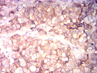 CD99 Antibody in Immunohistochemistry (Paraffin) (IHC (P))