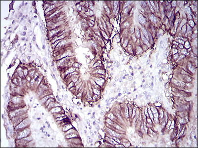 CDH17 Antibody in Immunohistochemistry (Paraffin) (IHC (P))