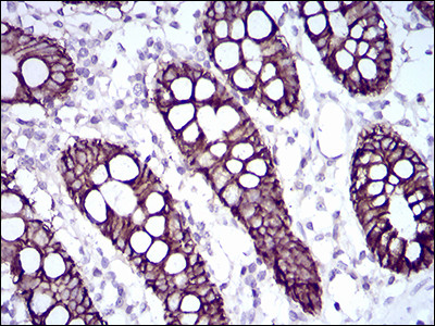 CDH17 Antibody in Immunohistochemistry (Paraffin) (IHC (P))