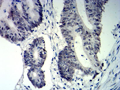 p57 Kip2 Antibody in Immunohistochemistry (Paraffin) (IHC (P))