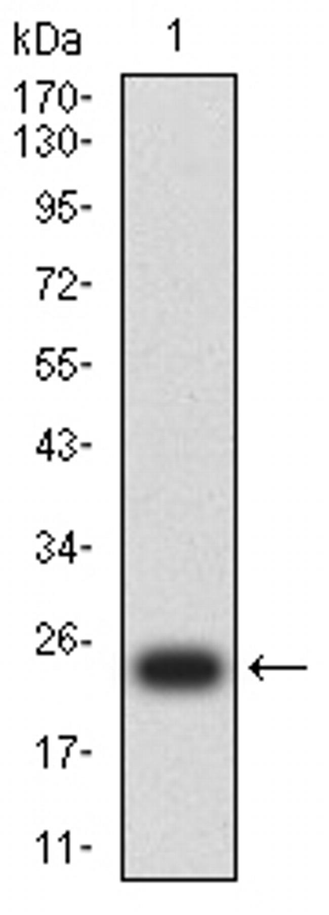 p57 Kip2 Antibody in Western Blot (WB)