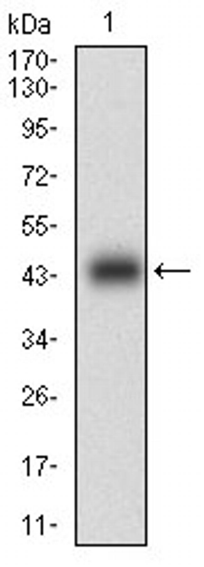 Calponin 1 Antibody in Western Blot (WB)