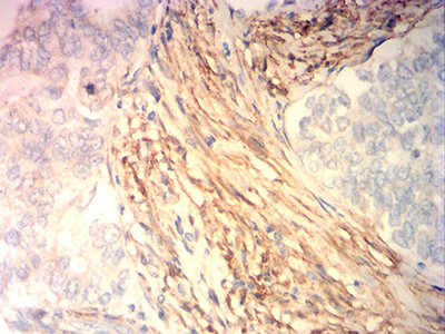 Calponin 3 Antibody in Immunohistochemistry (Paraffin) (IHC (P))