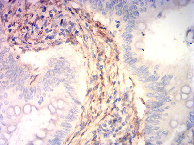 Calponin 3 Antibody in Immunohistochemistry (Paraffin) (IHC (P))