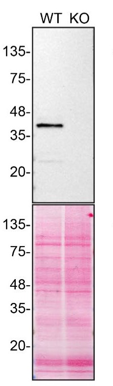 Calponin 3 Antibody in Western Blot (WB)