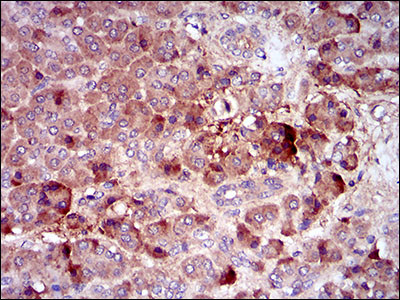 CSF1R Antibody in Immunohistochemistry (Paraffin) (IHC (P))