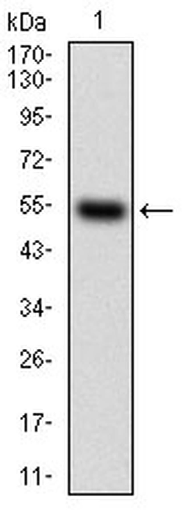 CSF1R Antibody in Western Blot (WB)