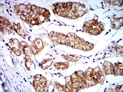 Catenin alpha-1 Antibody in Immunohistochemistry (Paraffin) (IHC (P))