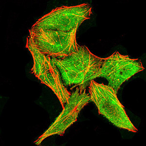 DDX3 Antibody in Immunocytochemistry (ICC/IF)