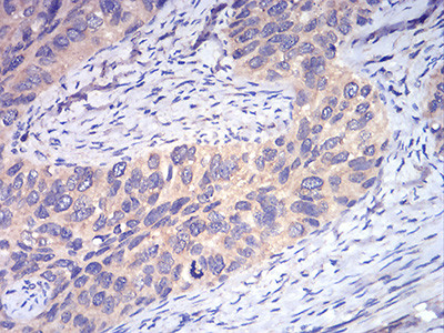 DDX3 Antibody in Immunohistochemistry (Paraffin) (IHC (P))