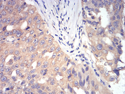 DDX3 Antibody in Immunohistochemistry (Paraffin) (IHC (P))