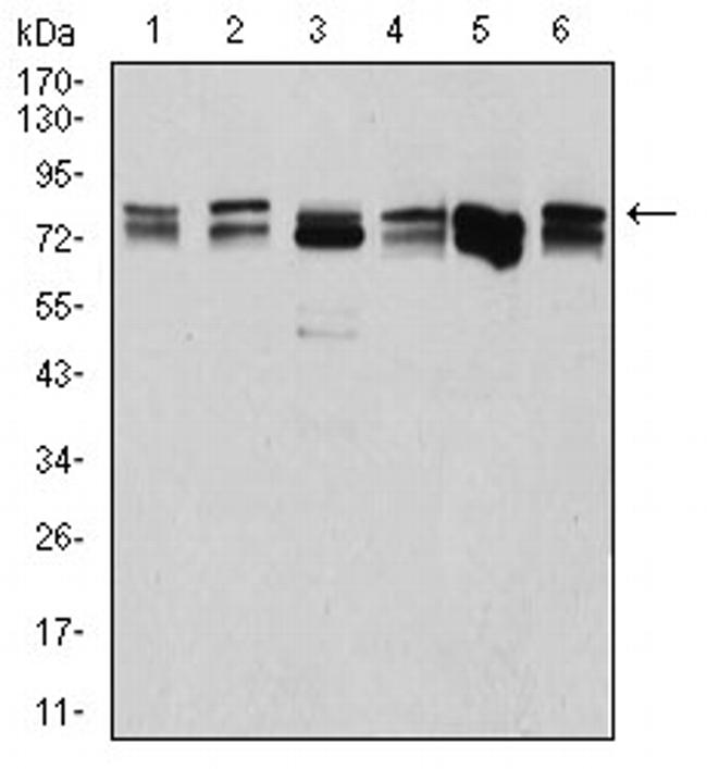 DDX3 Antibody in Western Blot (WB)