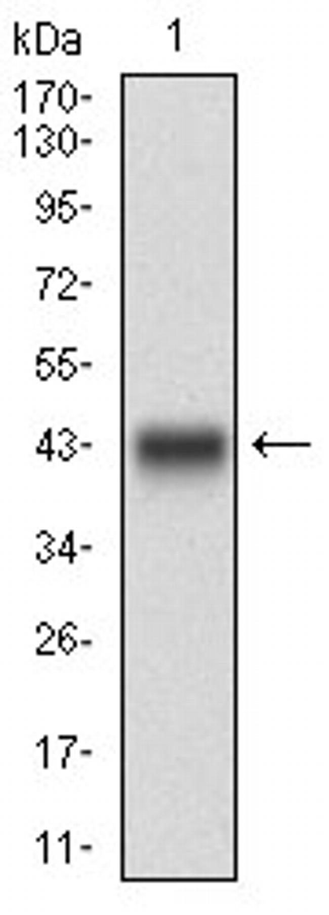 DNM1L Antibody in Western Blot (WB)