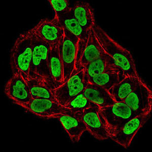 DNMT3B Antibody in Immunocytochemistry (ICC/IF)