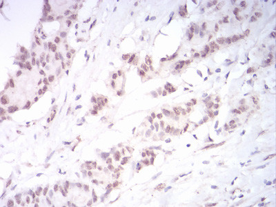 DNMT3B Antibody in Immunohistochemistry (Paraffin) (IHC (P))