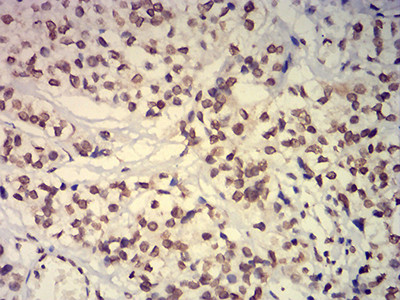 EHMT2 Antibody in Immunohistochemistry (Paraffin) (IHC (P))