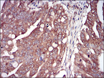 PKR Antibody in Immunohistochemistry (Paraffin) (IHC (P))