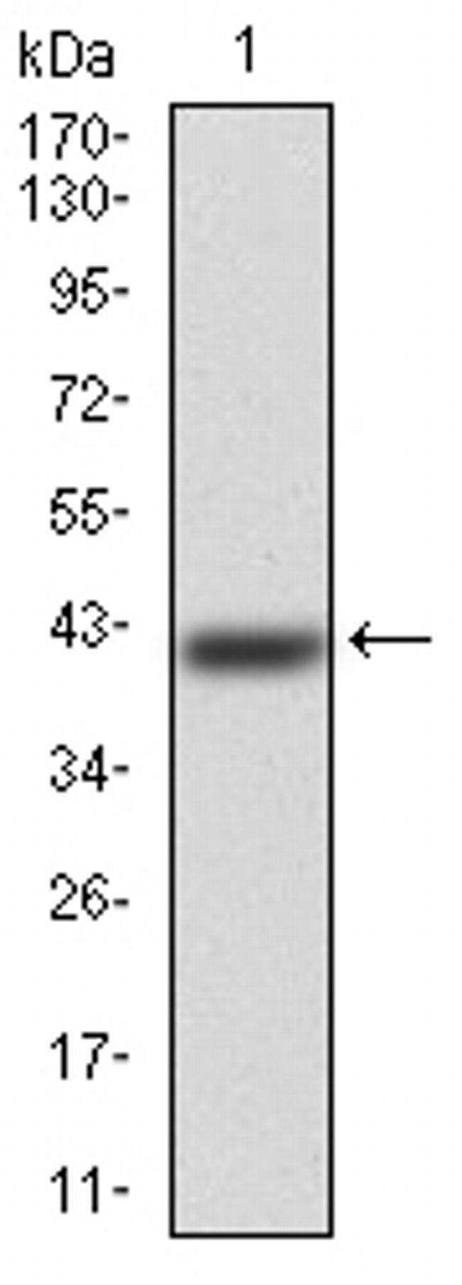 ERCC1 Antibody in Western Blot (WB)