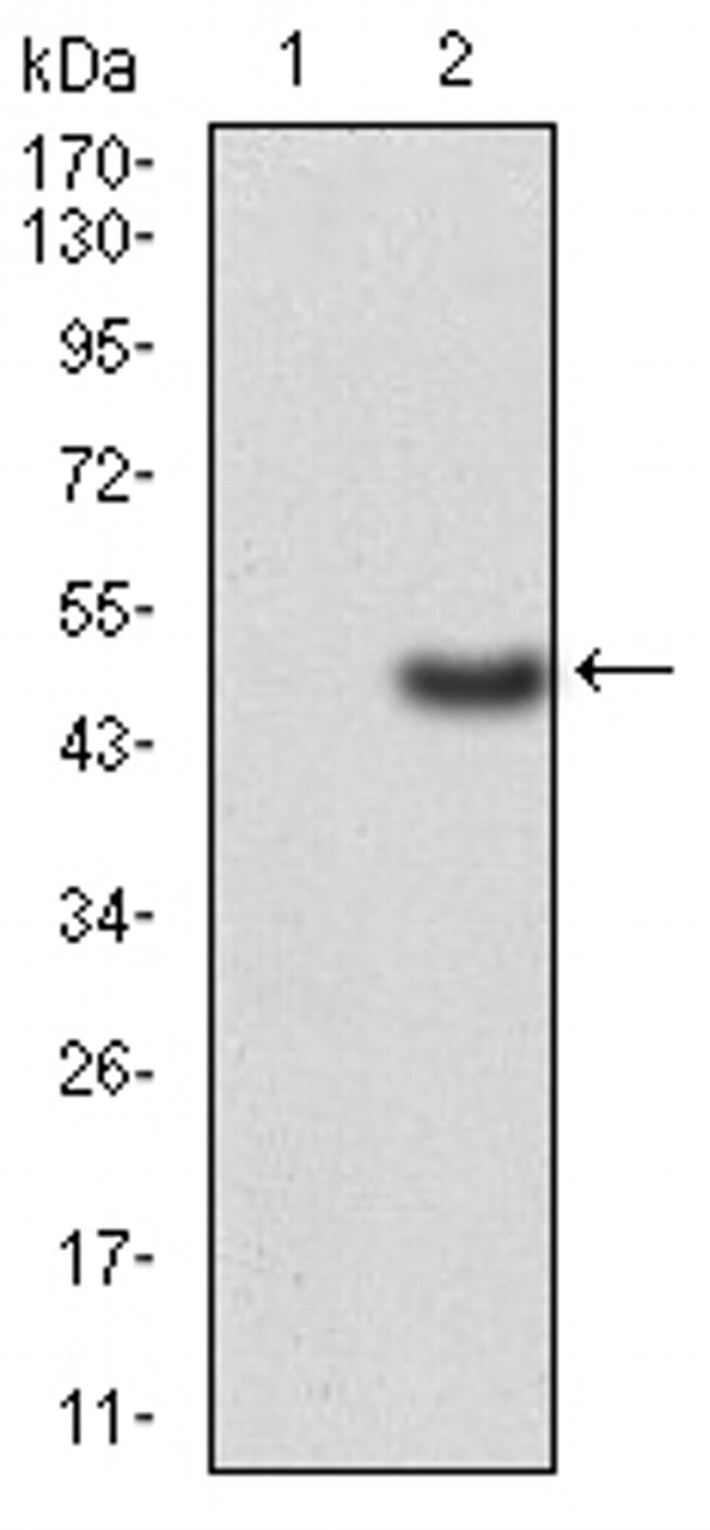 ERCC1 Antibody in Western Blot (WB)