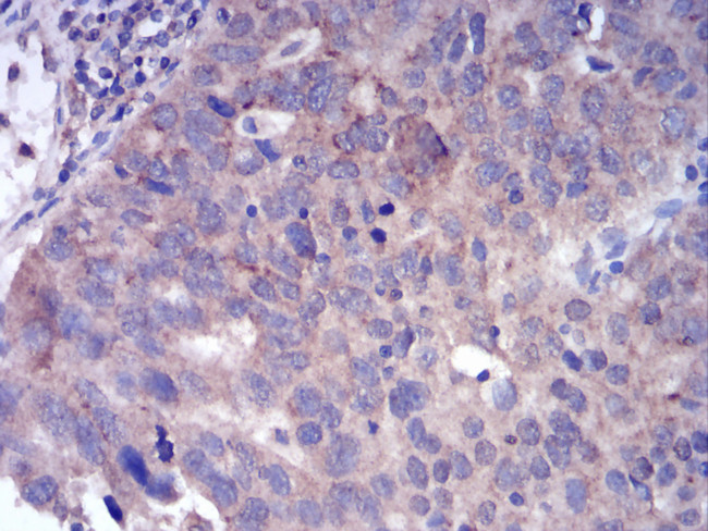 FGFR3 Antibody in Immunohistochemistry (Paraffin) (IHC (P))