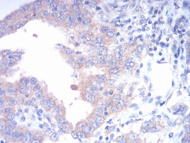 FGFR3 Antibody in Immunohistochemistry (Paraffin) (IHC (P))