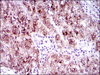 FLT3 Antibody in Immunohistochemistry (Paraffin) (IHC (P))