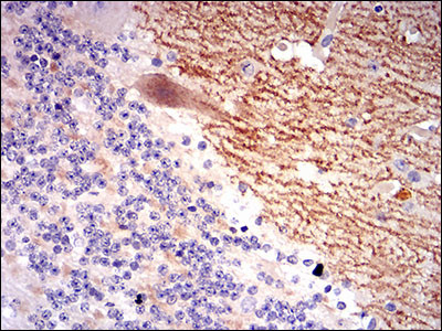 GABBR2 Antibody in Immunohistochemistry (Paraffin) (IHC (P))