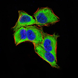 GLI1 Antibody in Immunocytochemistry (ICC/IF)