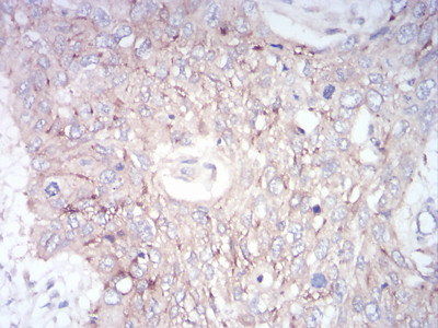 GLI1 Antibody in Immunohistochemistry (Paraffin) (IHC (P))