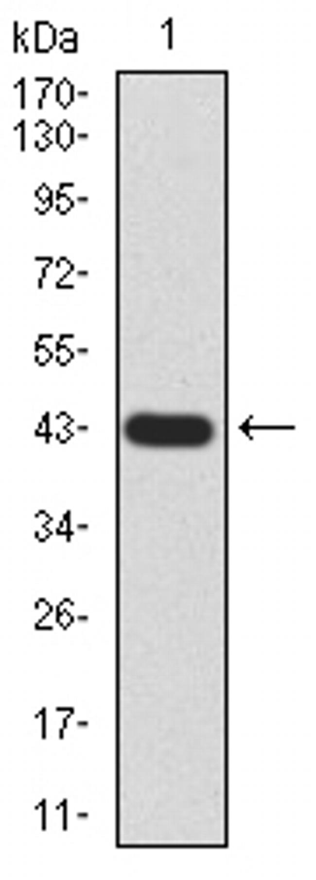 GLI1 Antibody in Western Blot (WB)