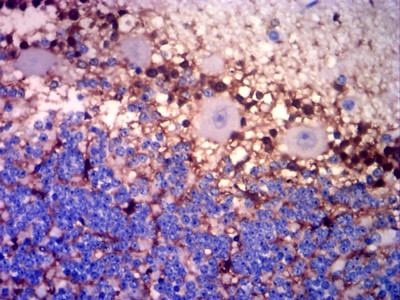 Glutamine Synthetase Antibody in Immunohistochemistry (Paraffin) (IHC (P))