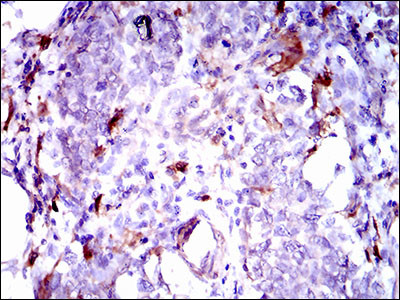 GPNMB Antibody in Immunohistochemistry (Paraffin) (IHC (P))