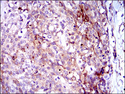 GPNMB Antibody in Immunohistochemistry (Paraffin) (IHC (P))