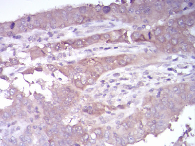 HDAC4 Antibody in Immunohistochemistry (Paraffin) (IHC (P))