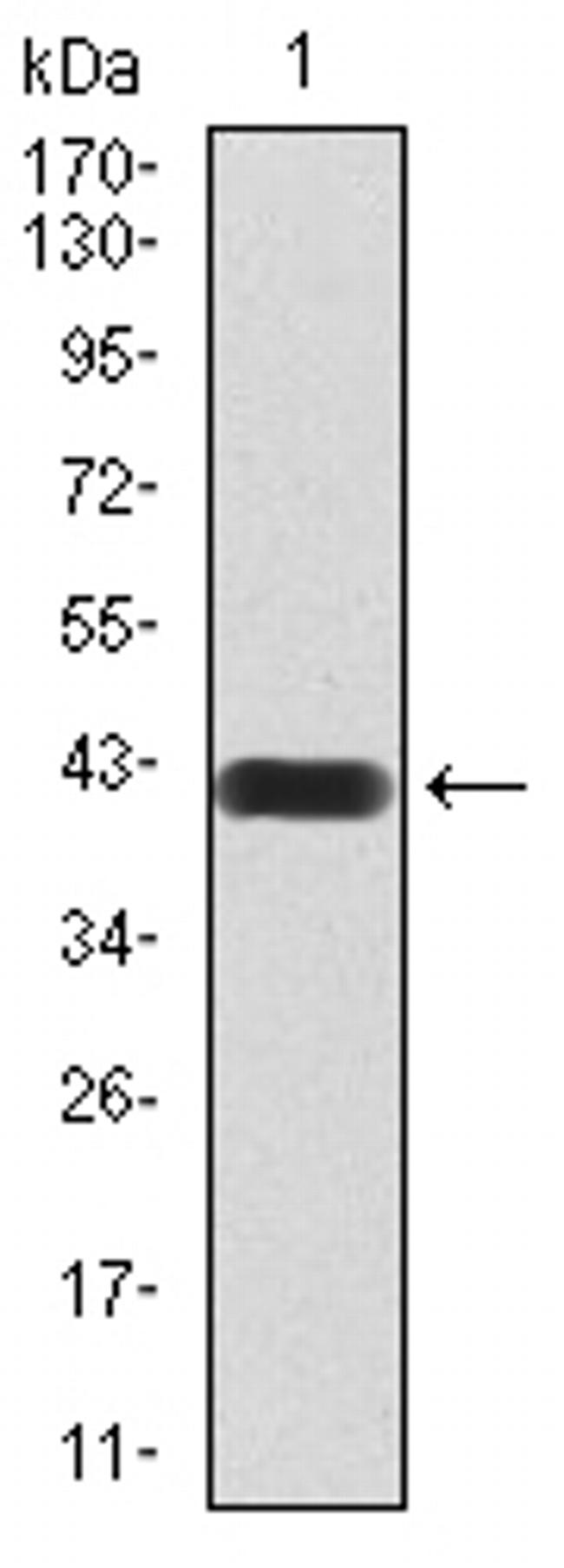 HDAC4 Antibody in Western Blot (WB)