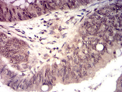 HTRA2 Antibody in Immunohistochemistry (Paraffin) (IHC (P))