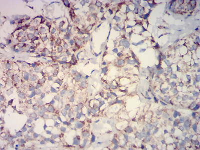 IDH2 Antibody in Immunohistochemistry (Paraffin) (IHC (P))